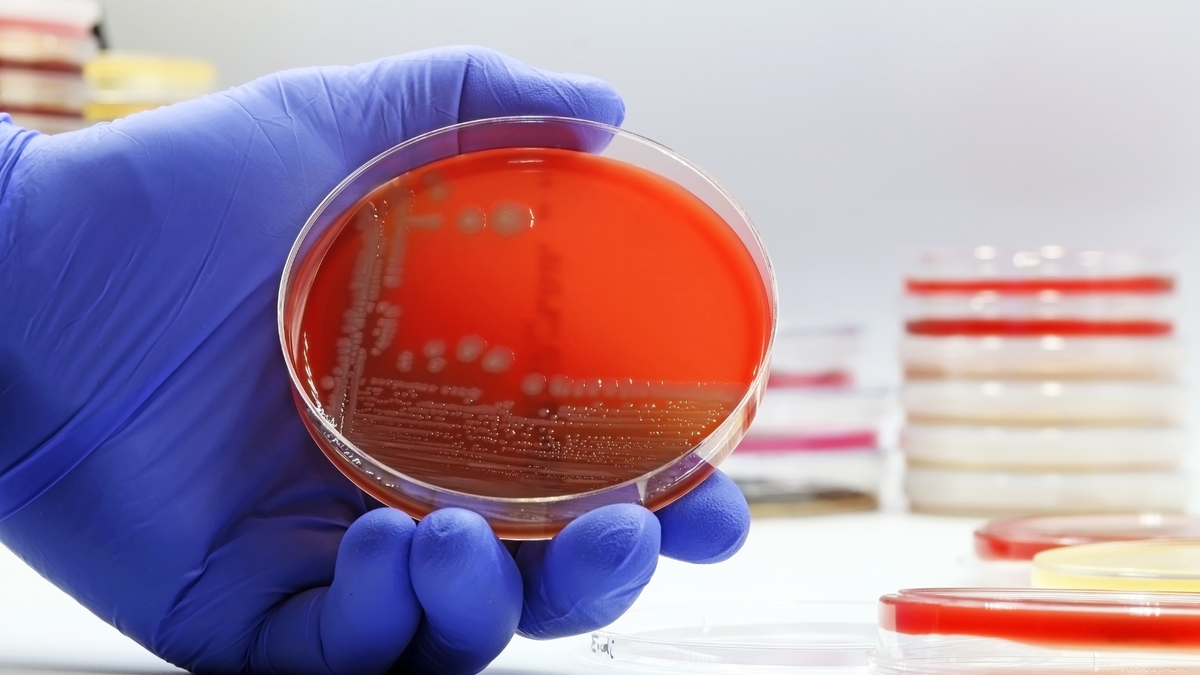 Thrush & Bacterial Vaginosis (BV) Uncovered: Dr Phillip Hay's 30