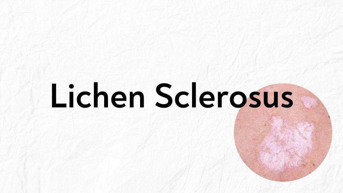 a patch of white and pinkish skin a lichens sclerosus patch