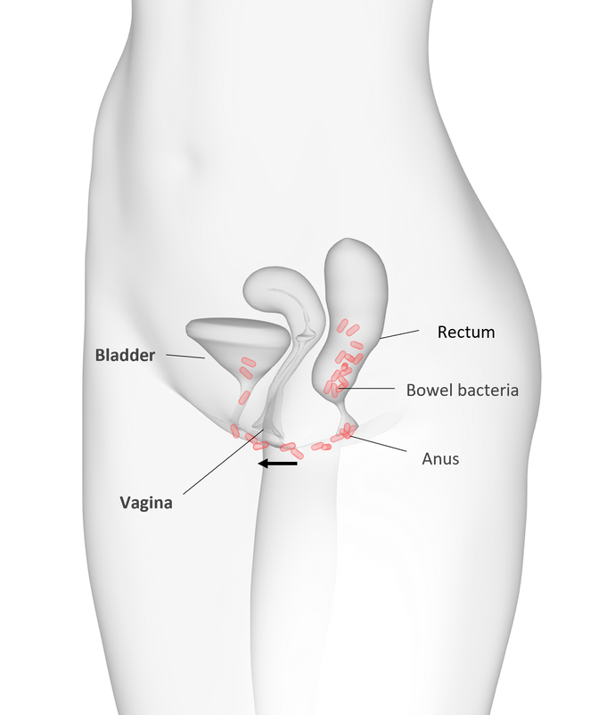 a diagram of the female ural-vaginal system demonstrating how bacteria travels around